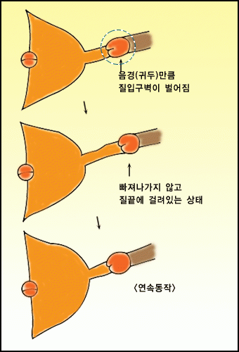 남성 하이테크닉(5) 이미지 #3