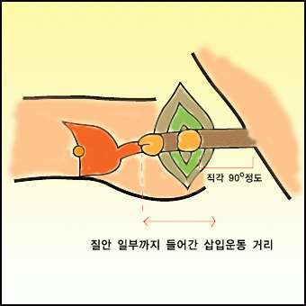 남성 하이테크닉(5) 이미지 #2